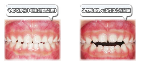 院内