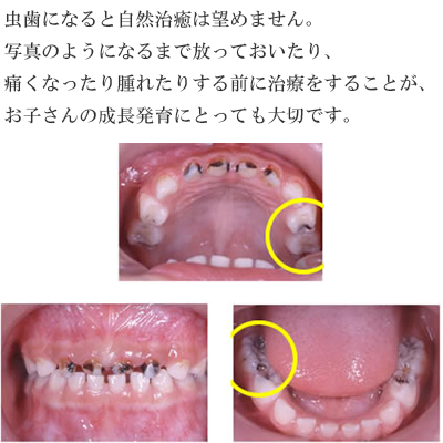 小児歯科