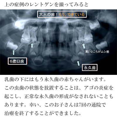 小児歯科