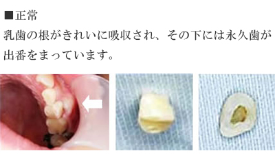 小児歯科