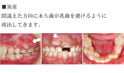 小児歯科