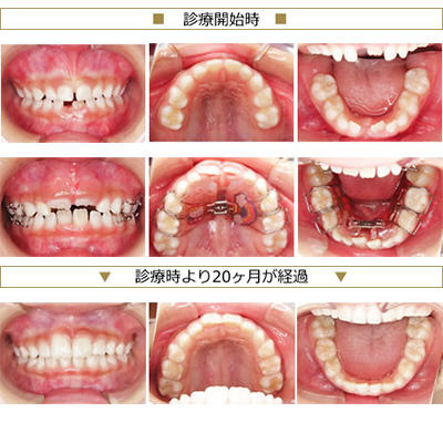 症例紹介